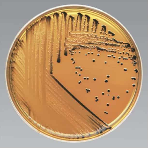 Detección de Salmonella y Shiguella